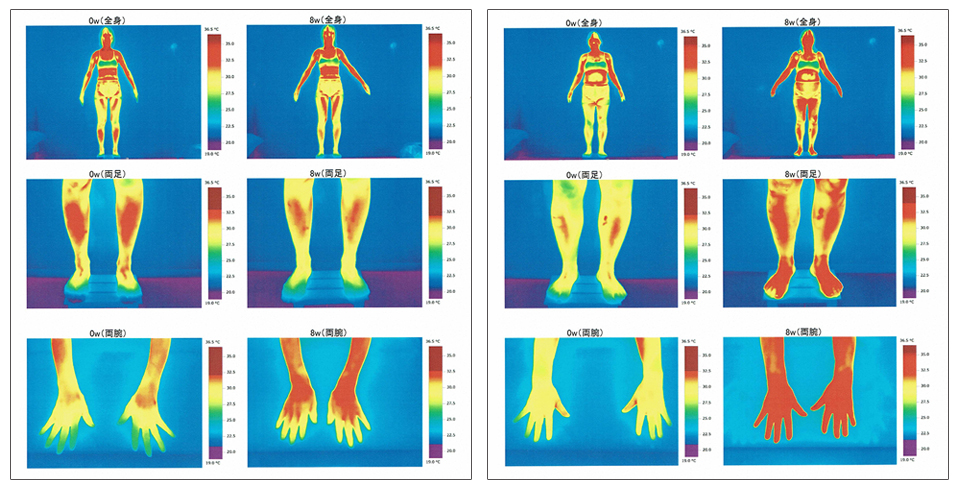 ハワイアン酵素を飲む前と飲んだ後の体温のサーモグラフィ